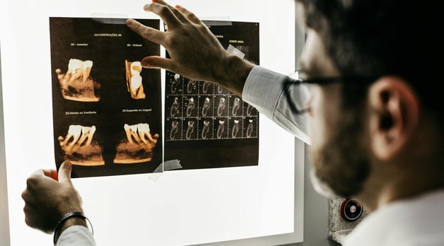un dentista viendo unas radiografías dentales