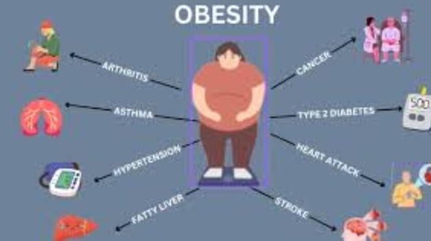 diseases and obesity