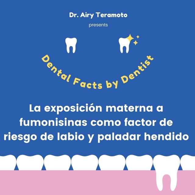 labio y paladar hendido
