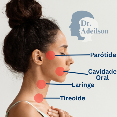 Tumores de cabeça e Pescoço com Dr. Adeilson