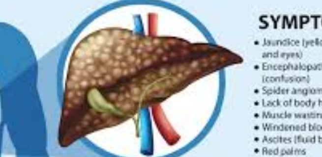 Fatty Liver Disease irreversable cirrosis