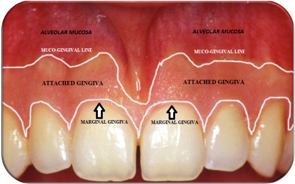 an image showing parts of gingiva