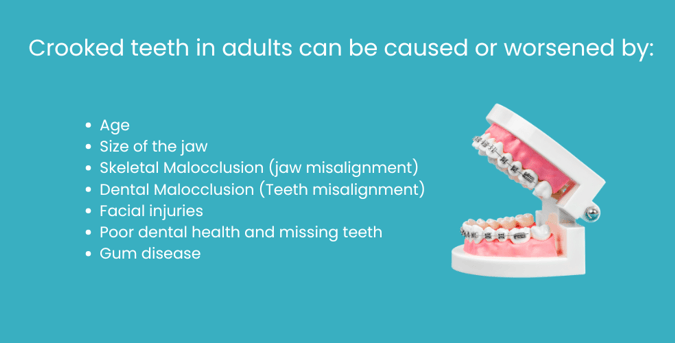 crooked teeth in adults - understanding your options