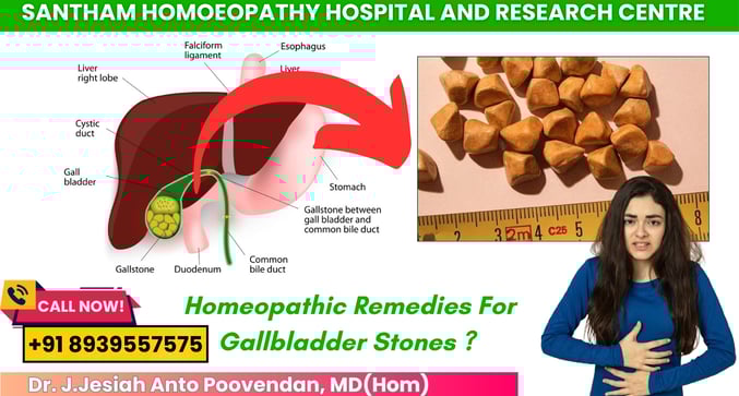 Homeopathy treatment for gallstones in Chennai