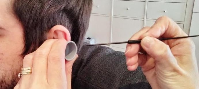 A client having ear wax removal with curettage 