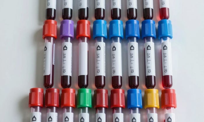 KeyNonvac tubes