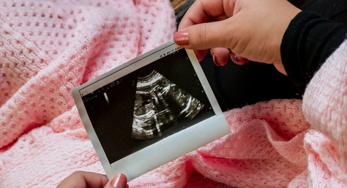 a woman holding a baby's ultrasound scan