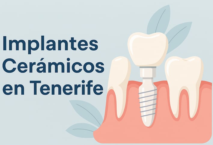 Ceramic dental implants Tenerife