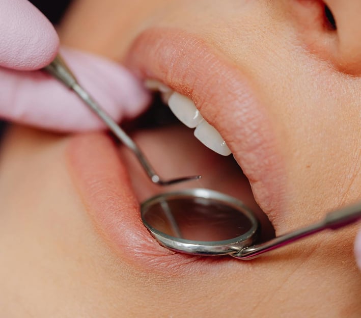 dentist examining a woman's mouth