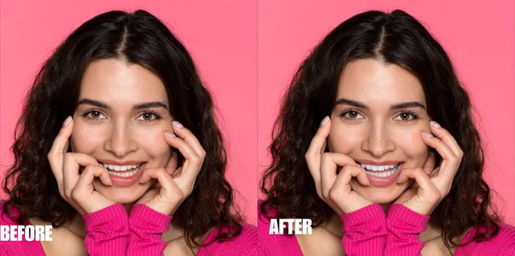 teeth-color-correction