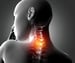 Cervical Spondylosis