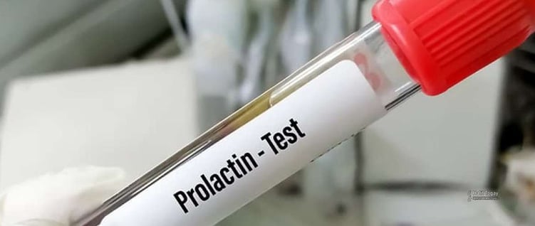 Prolaktin Hormonu Nedir? Yüksekliği ve Düşüklüğü Ne Anlama Gelir?