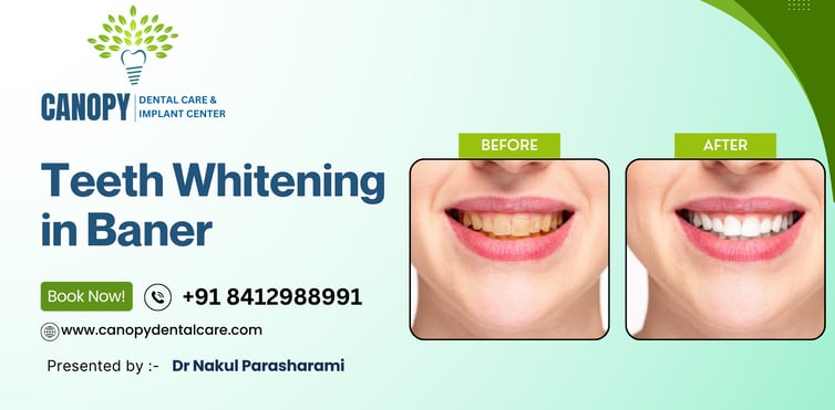 teeth whitening in baner