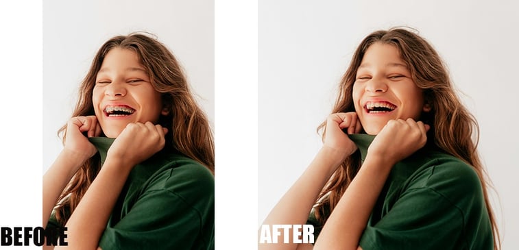 braces-removal