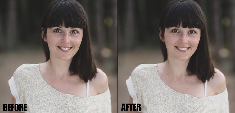 eye-correction