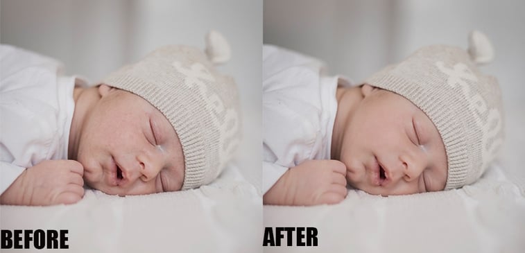 skin retouching before and after