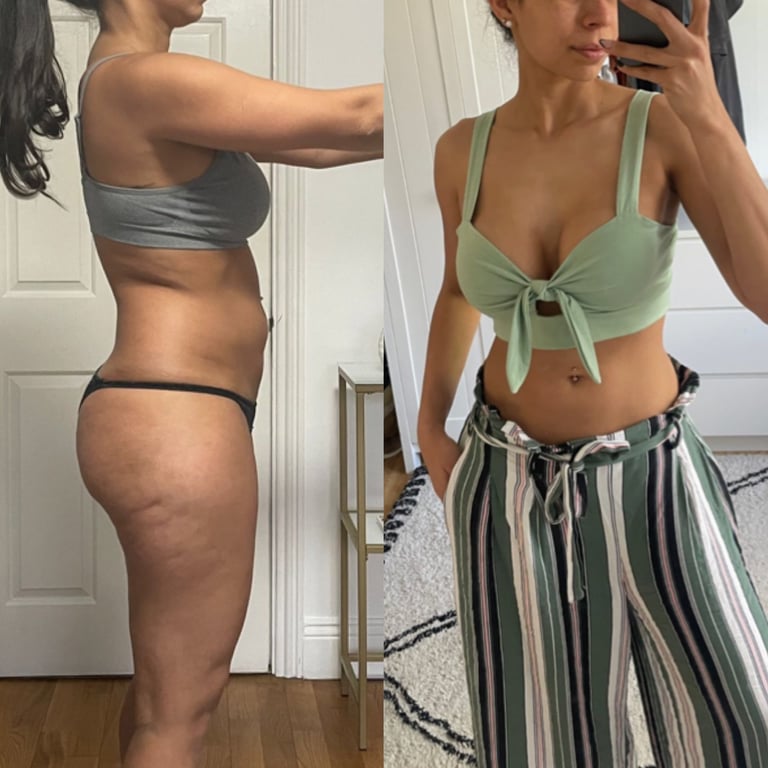 Before and after — female side profile with visible hip and thigh fat; after front selfie with a leaner waist and defined mid