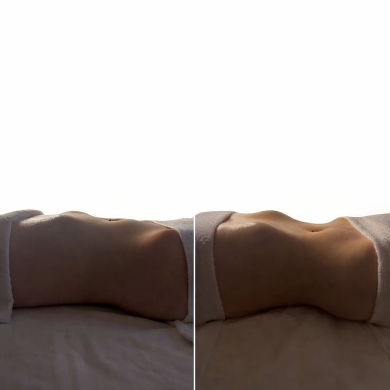 Side-by-side comparison of a female abdomen showing stomach vacuum exercise results for core toning.