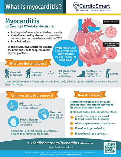 Infographic explaining myocarditis heart muscle inflammation symptoms, diagnostic tests, and treatment options.