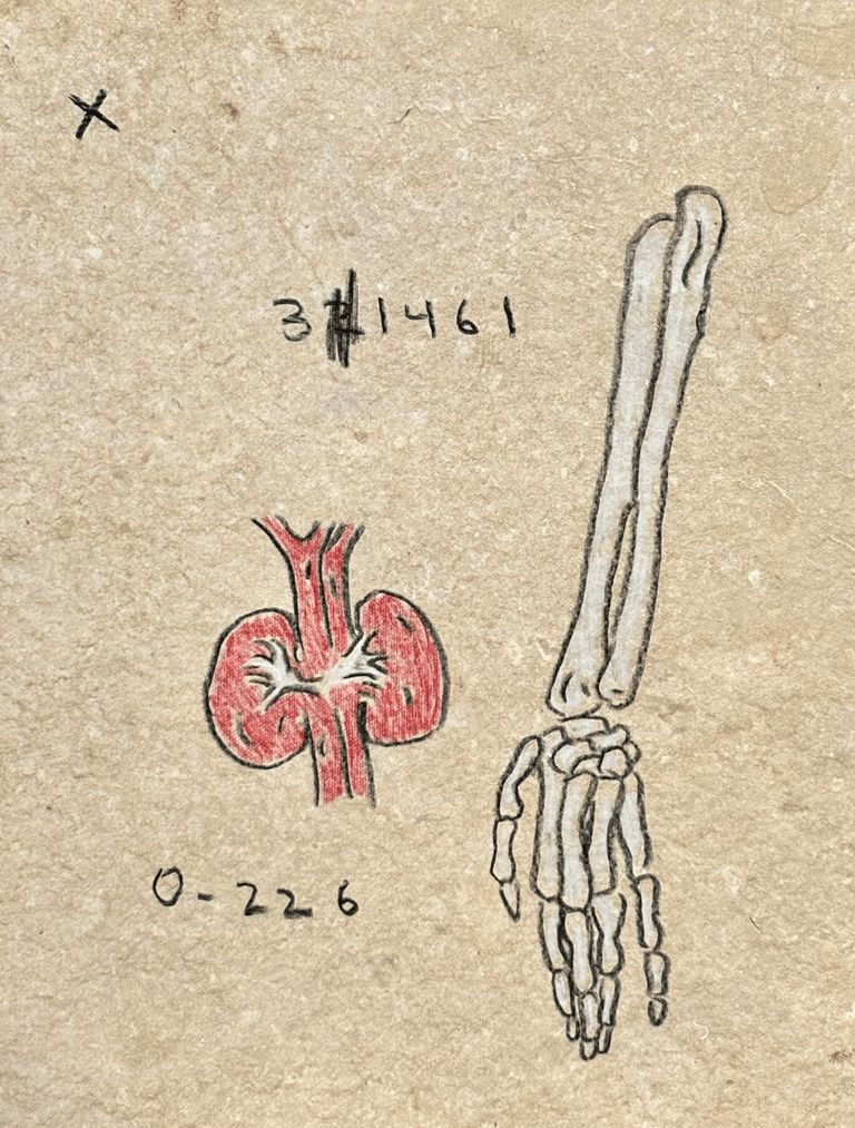 Rough sketch of the anatomy of the lower arm and kidneys and computer code