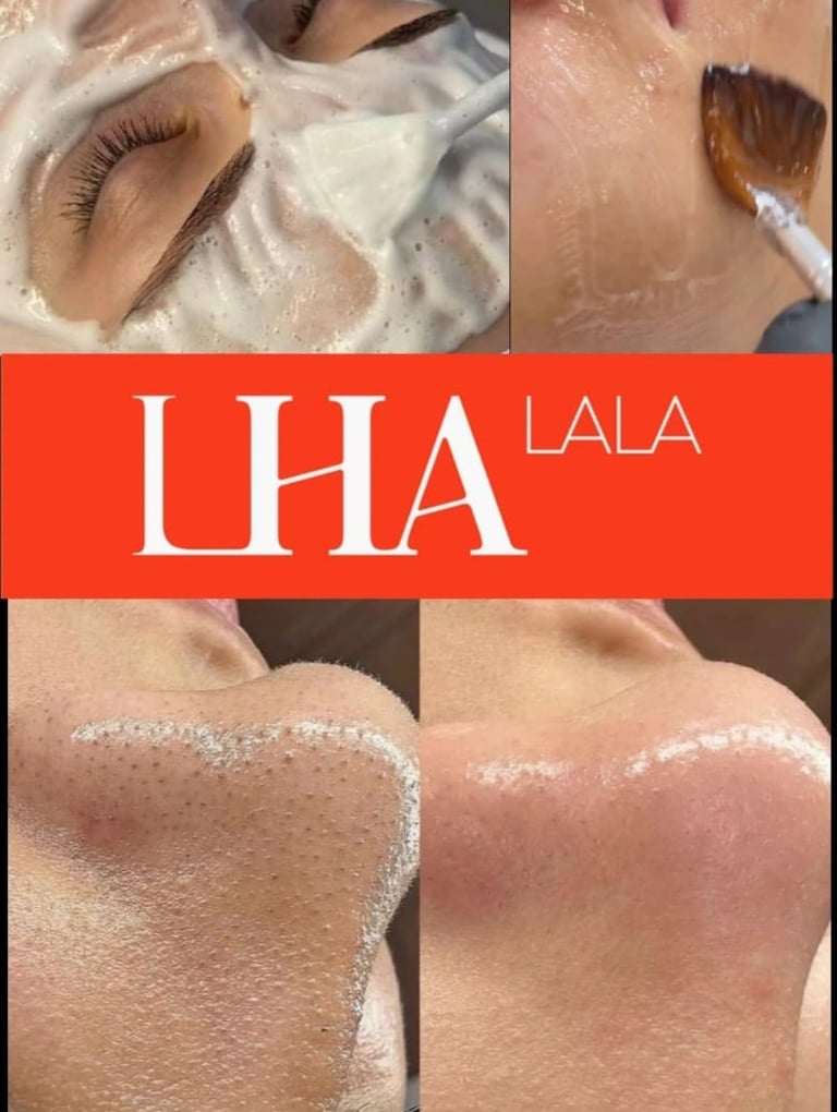 lha la peel em bh