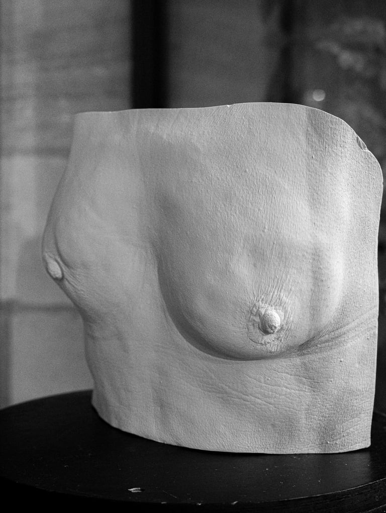 Moulage plâtre - cancer du sein  - Moulage intime Bordeaux