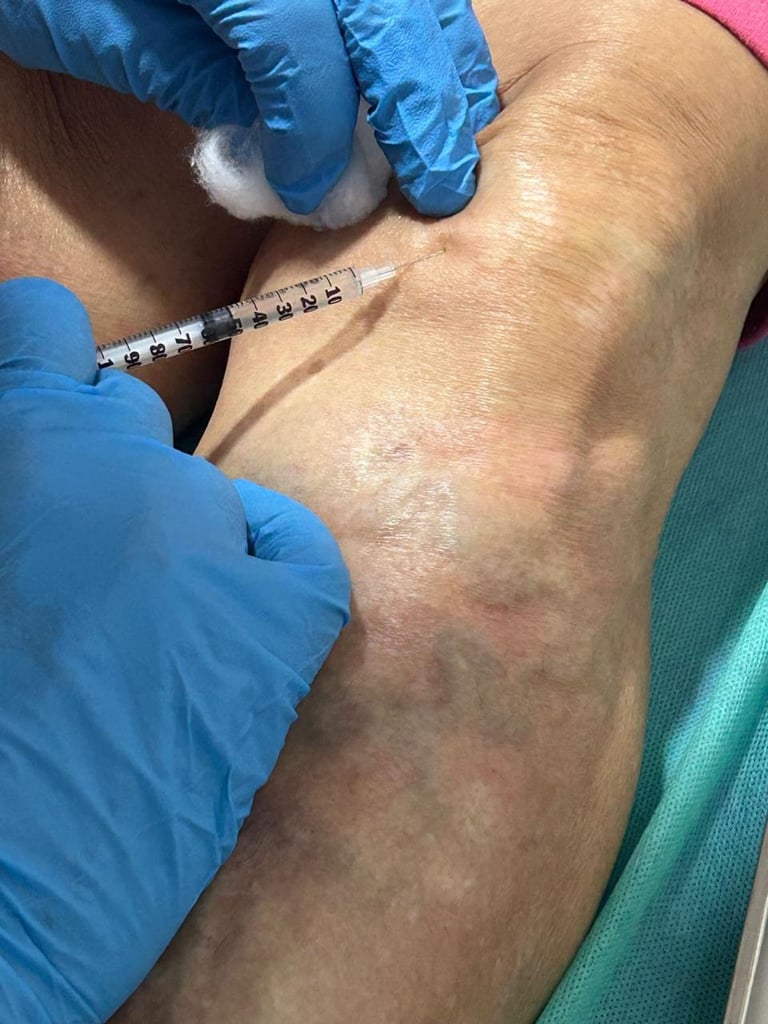 Protocolo de Aplicación de Apitoxina Inyectable