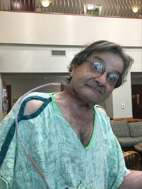 surgery for my cancer healing