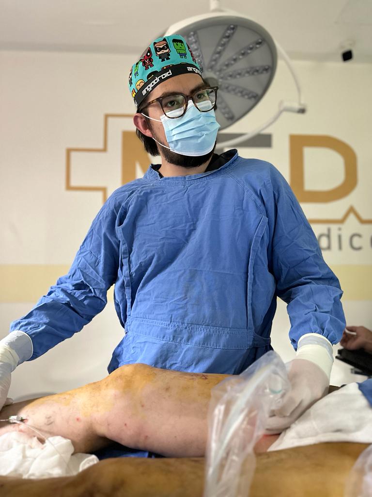 Cirugía Laser para Varices (EVLA)