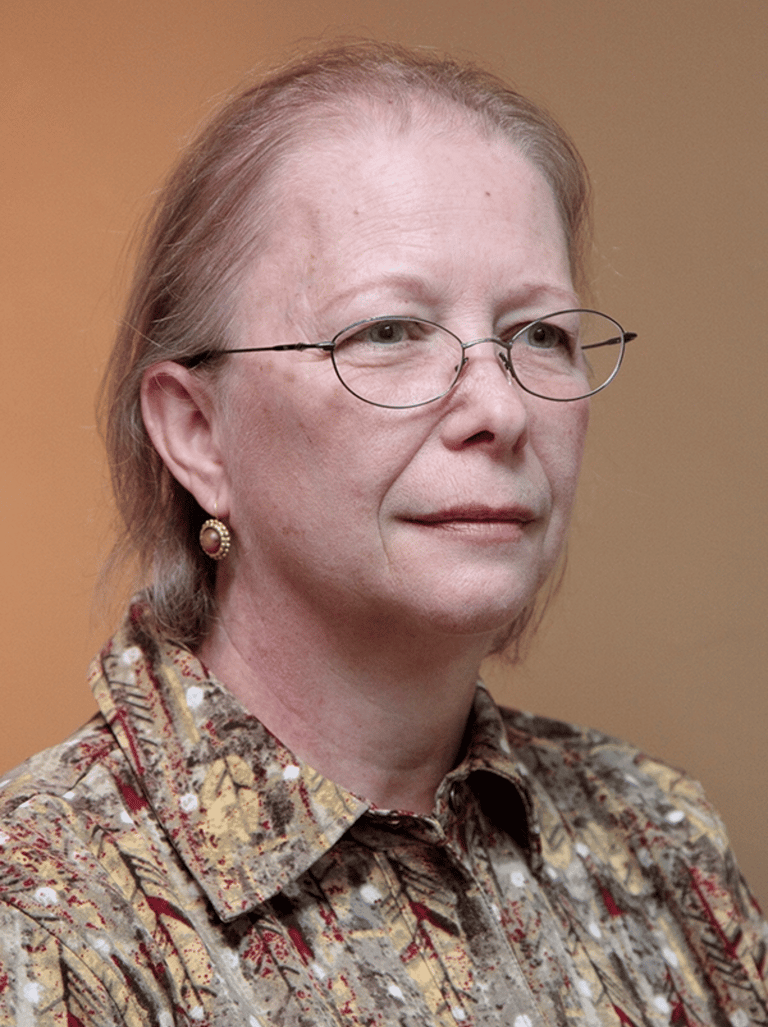 Before permanent non-surgical hair replacement – overall thinning hair showing scalp through the par