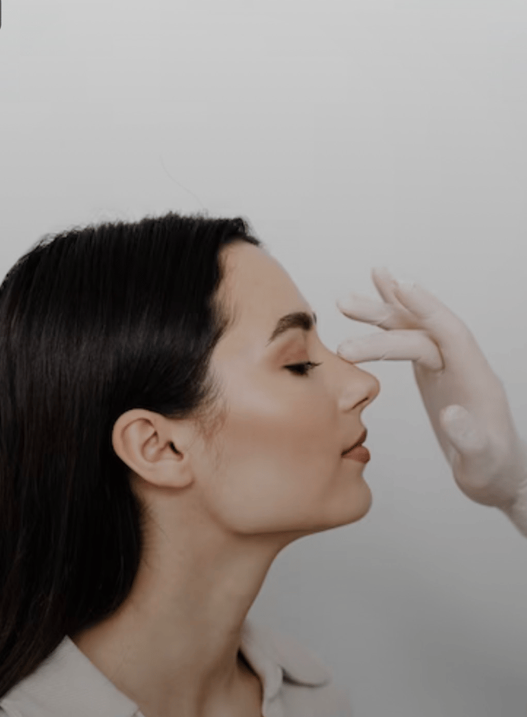 Rinoplasti (burun estetiği) sonrası yüz ile uyumlu burun görünümü