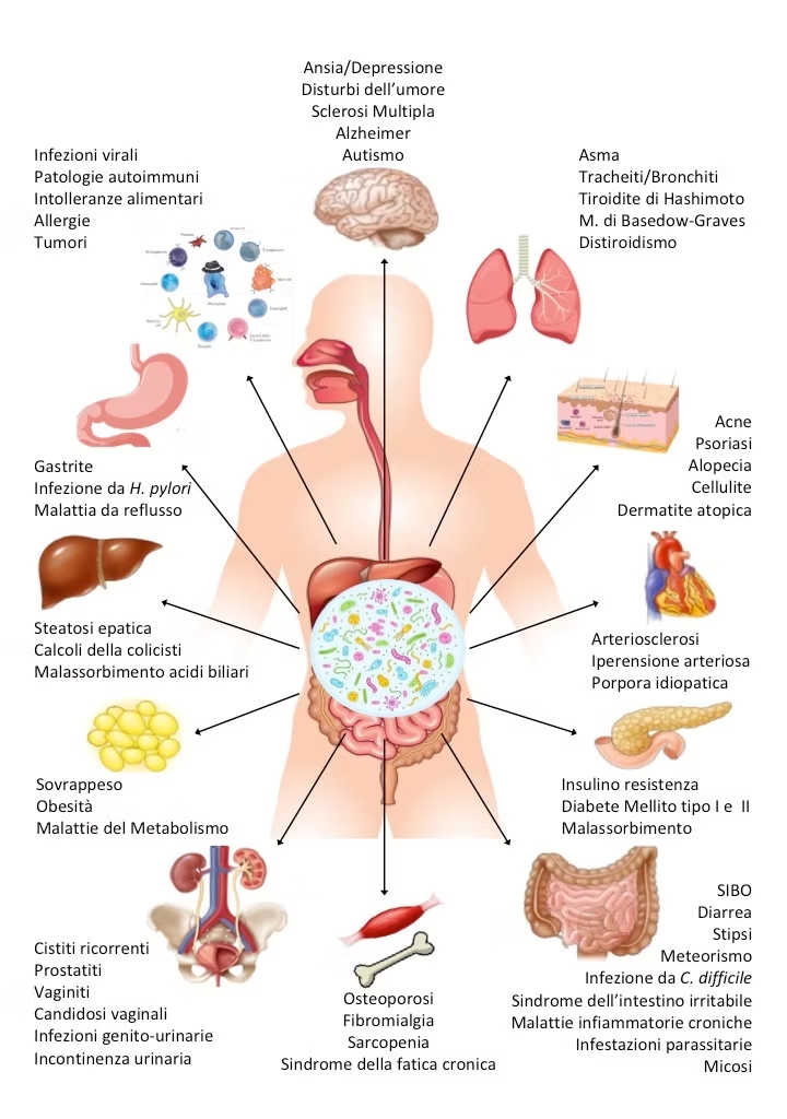 microbiota e malattie croniche