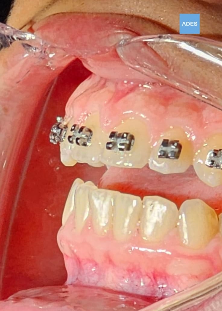 Sala de ortodoncia en Clínica Dental ADES