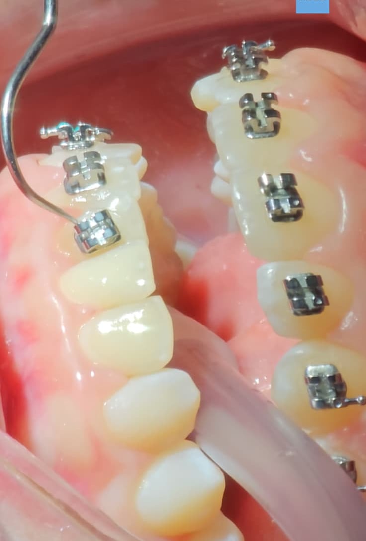 brackets metalicos badajoz