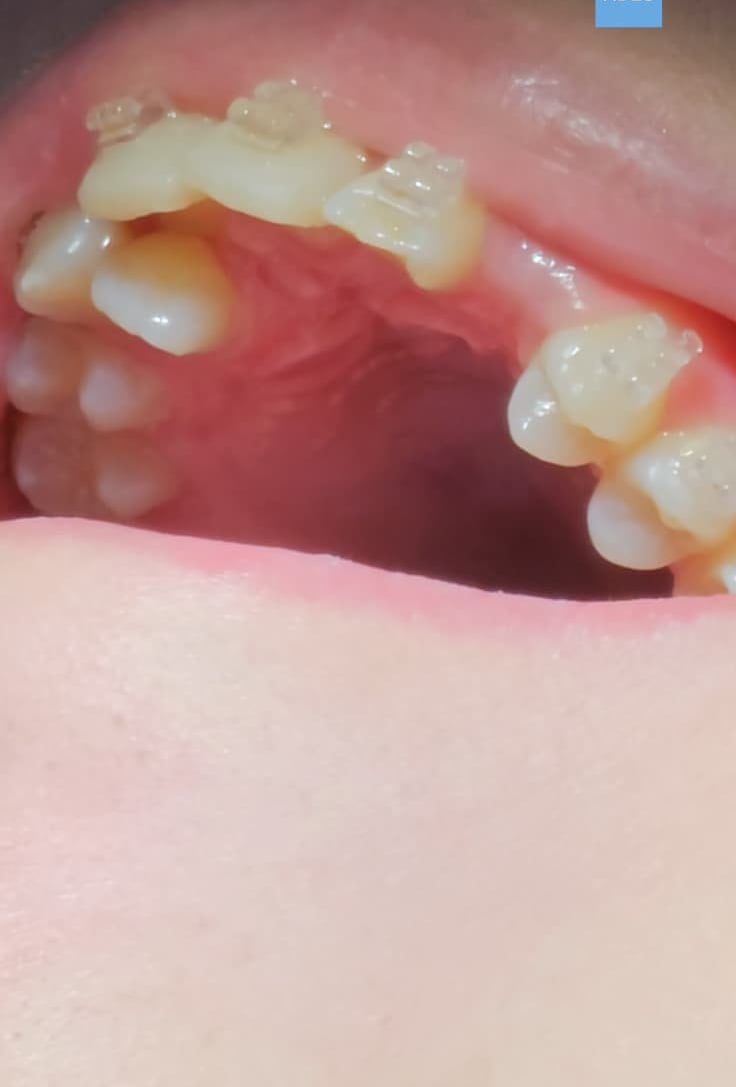 Niños en clínica dental en Badajoz