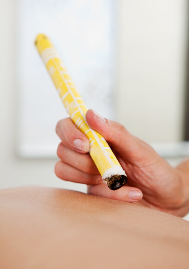 Séance de médecine chinoise, pratique du Moxa