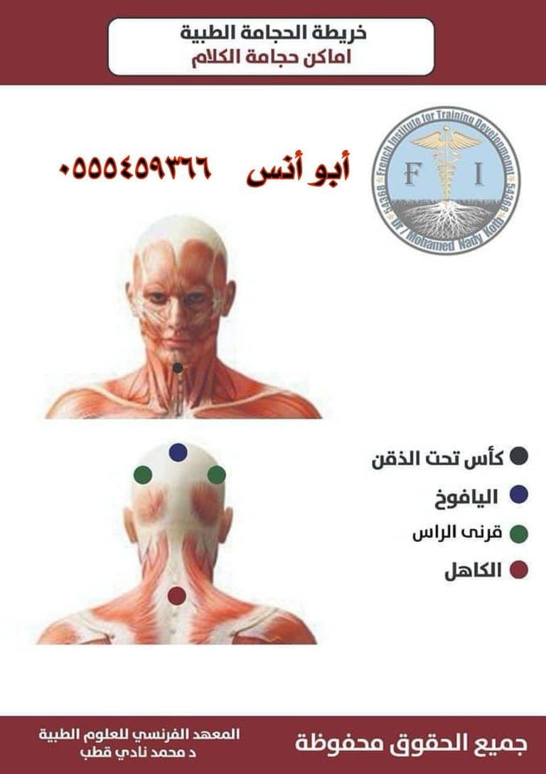 حجامه منزليه في مكه