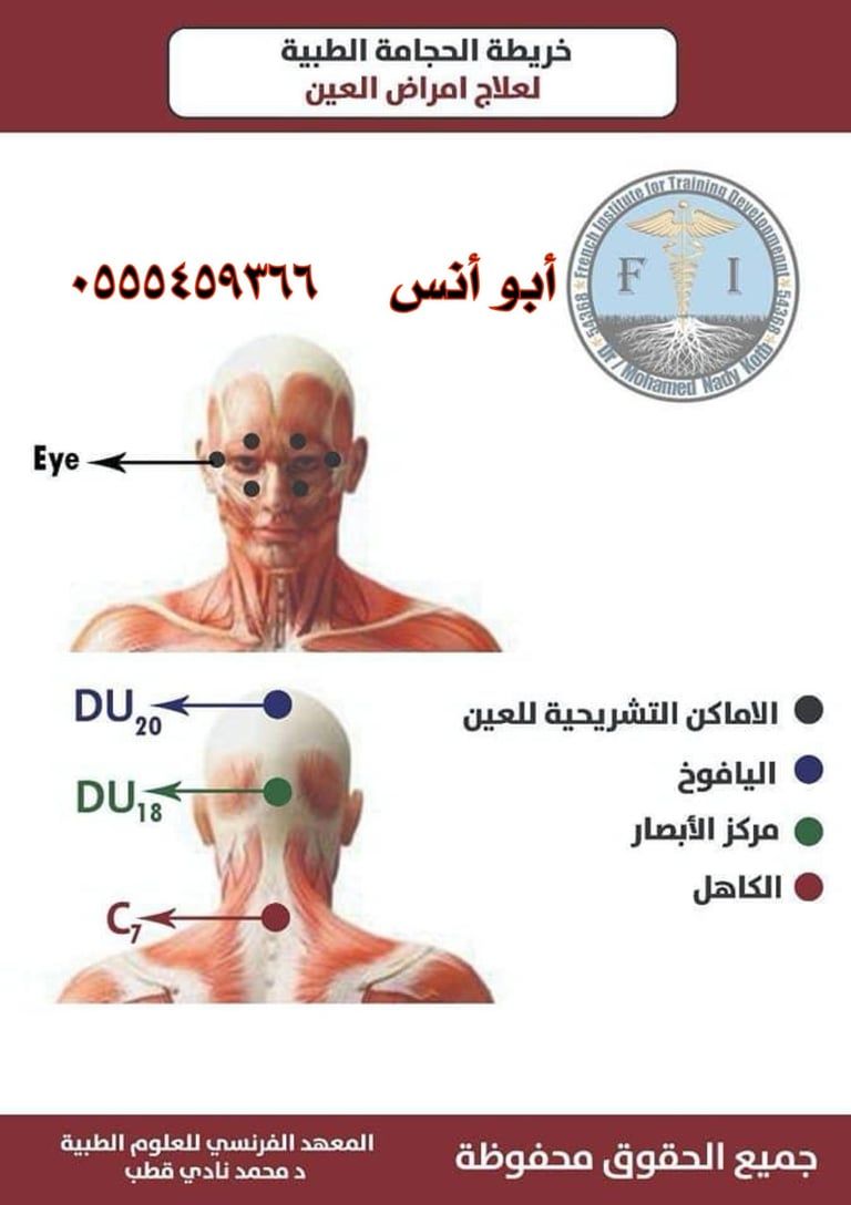 حجامه منزليه بمكه