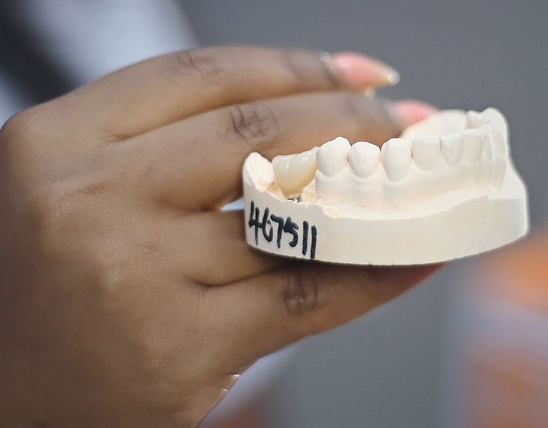 Prothésiste tenant un modèle en plâtre avec une couronne en céramique sur mesure.