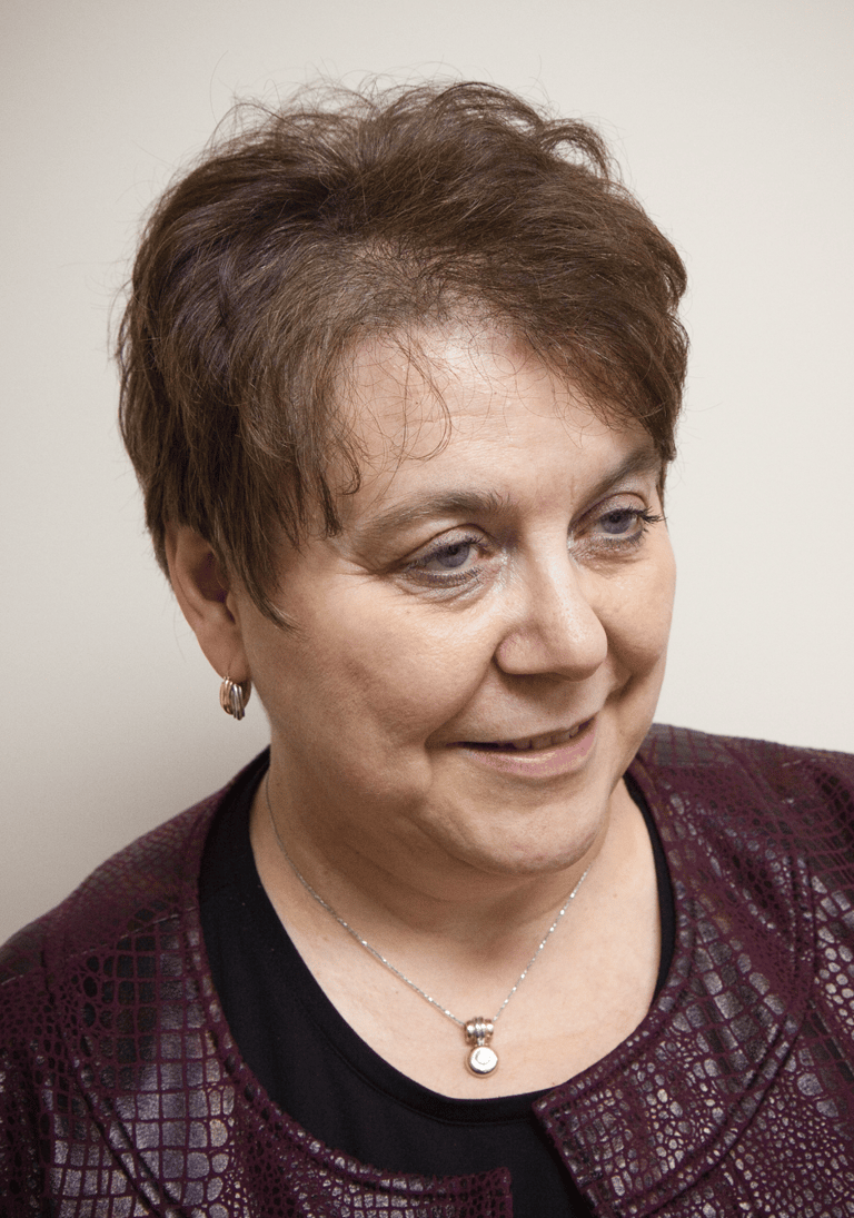 Before permanent non-surgical hair replacement – visible thinning and hair loss at the crown 