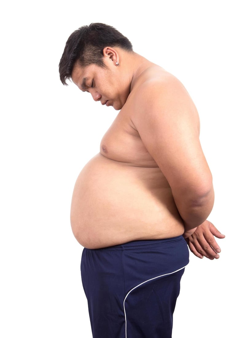 homme gros ventre surpoids obese