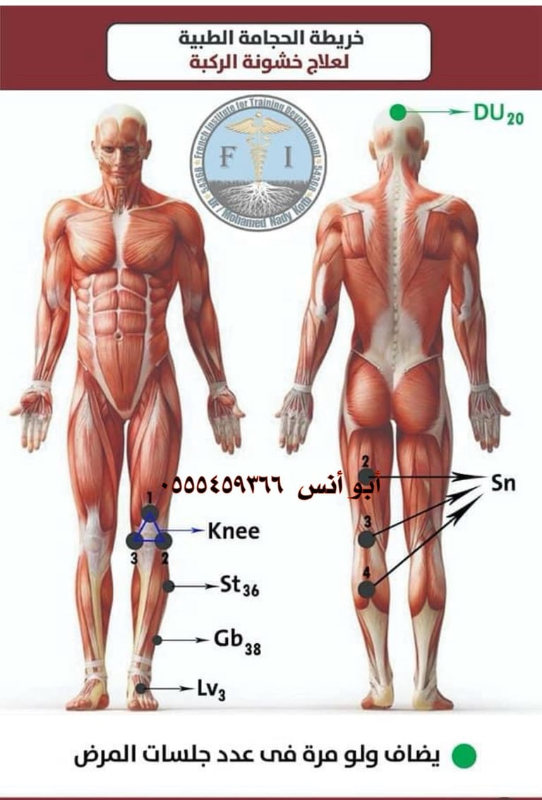 حجامه منزليه مكه