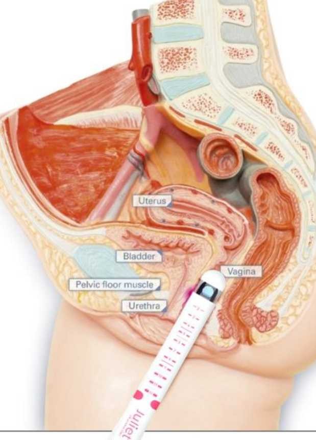 фото Схема використання Juliet