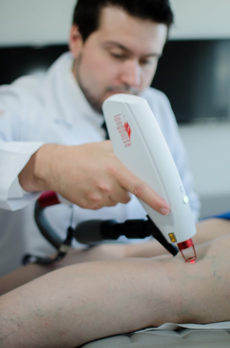 Cirurgião Vascular Lucas Vinicius Brun realizando procedimento de Laser Transdermico para varizes