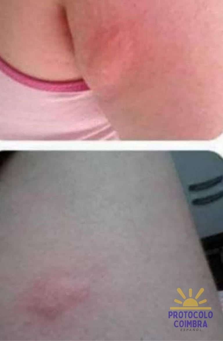 Photos with side effects of the conventional medication.