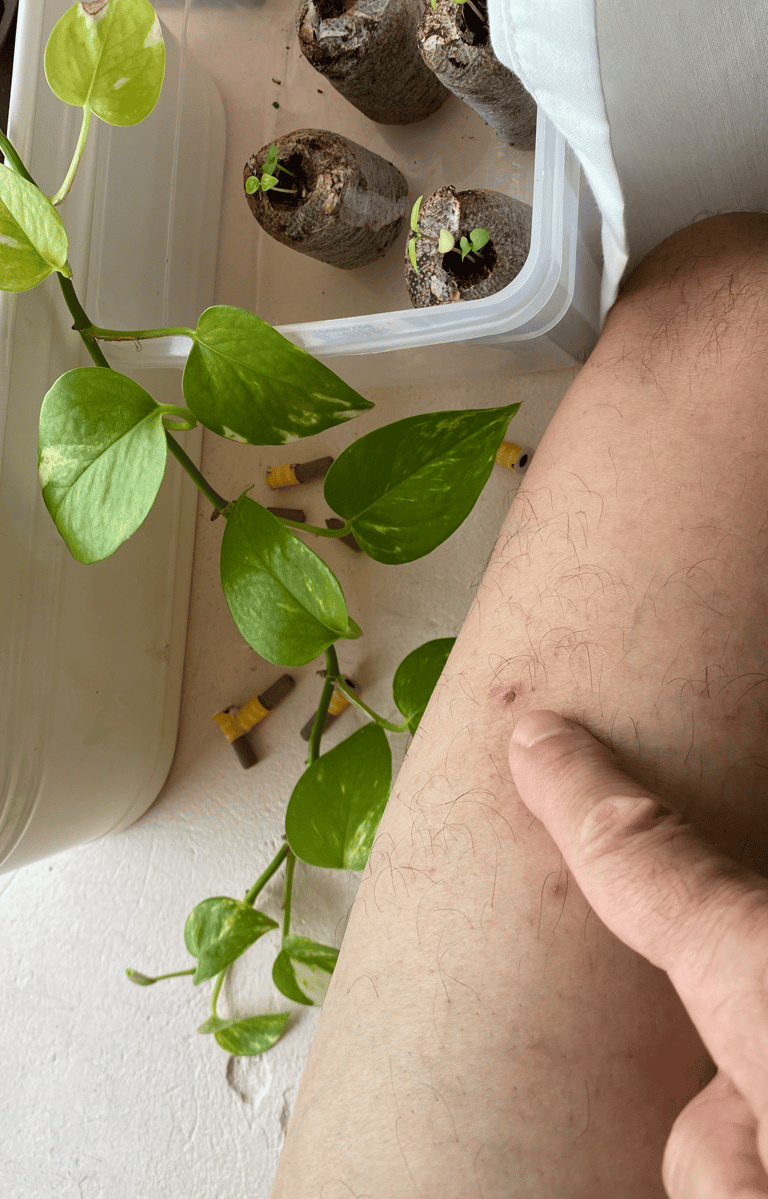 kim soo is pointing to a small mild burn on his leg from moxa. There is a green plant on the left