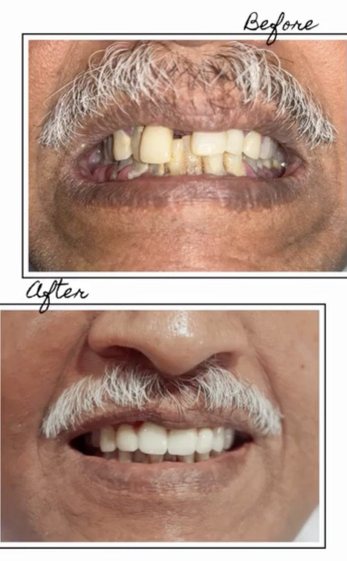 Dentist in Bangalore