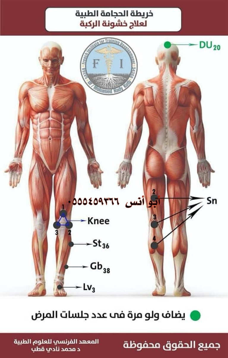 اخصائي حجامه منزليه مكه