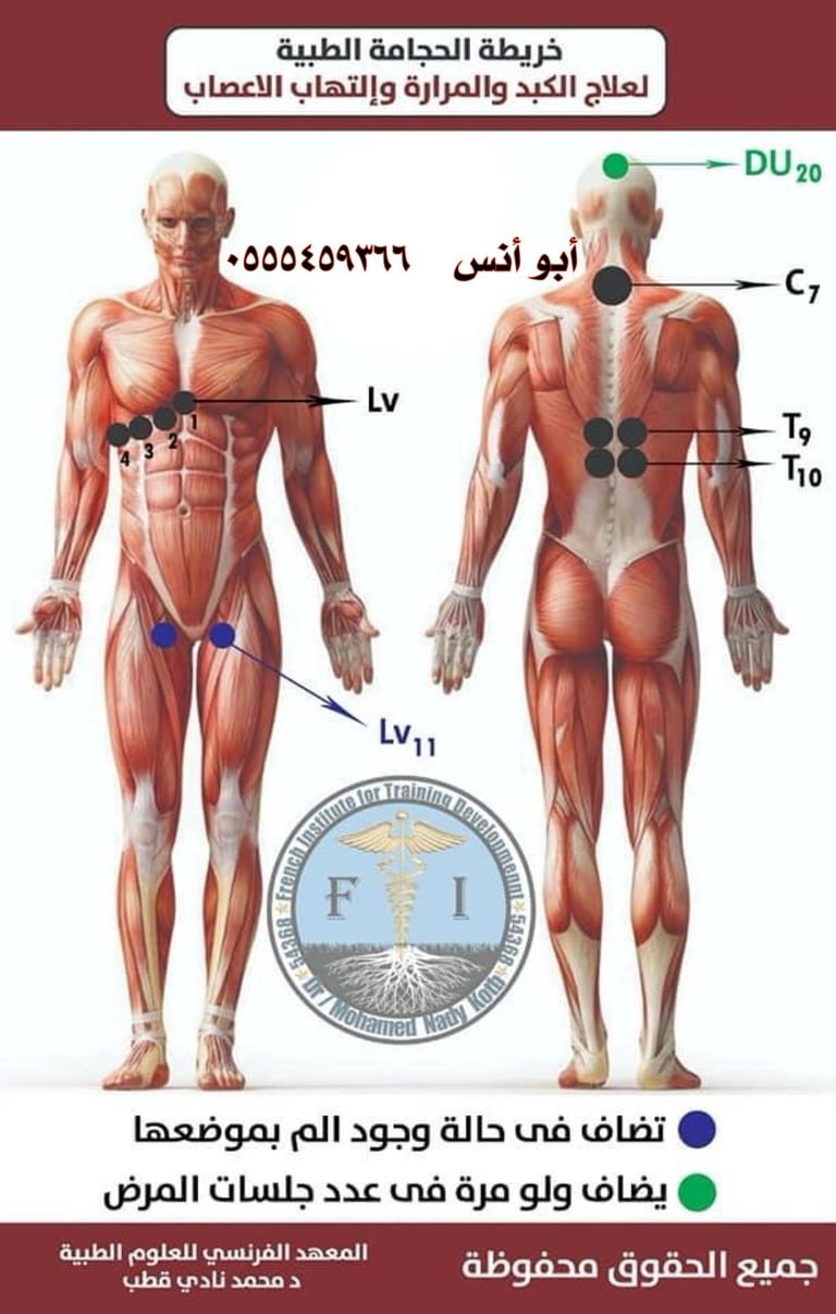 حجامه في مكة
