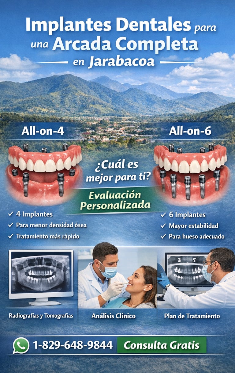 Implantes dentales para una arcada completa en Jarabacoa